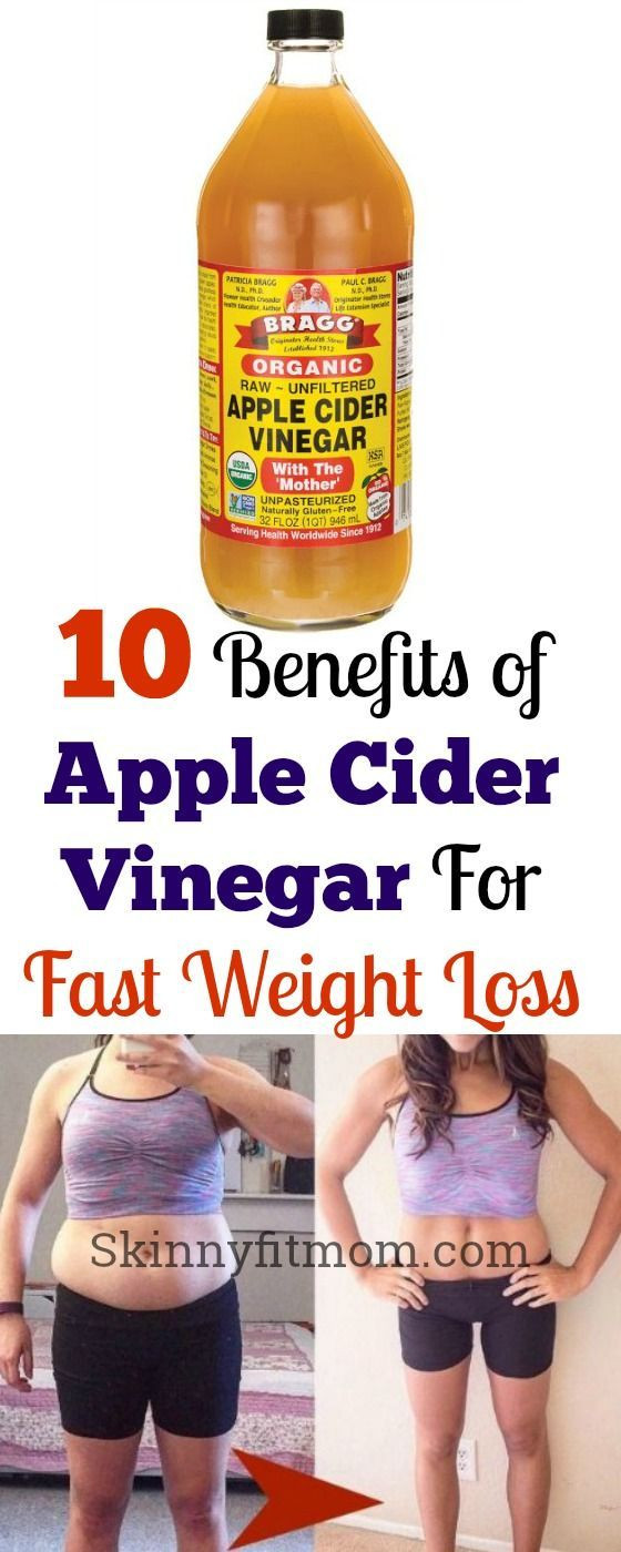 Apple Cider Vinegar For Weight Loss In 1 Week
 How to Use Apple Cider Vinegar for Weight Loss and Benefits