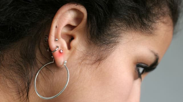 Earring In Right Ear
 Earring Infection