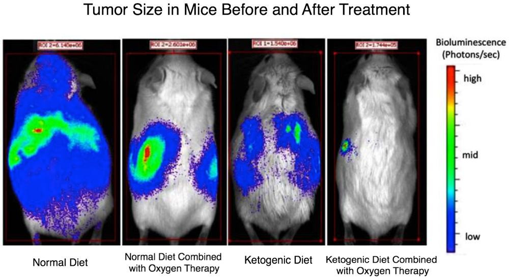 Keto Diet Cancer
 Study Shows What A Ketogenic Diet Did To Mice With