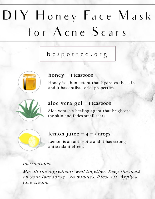 Acne DIY Mask
 DIY Honey Face Mask for Acne Scars