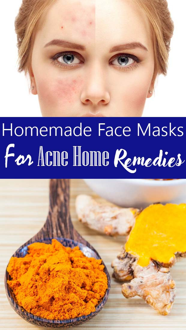 Acne DIY Mask
 Great Homemade Face Mask For Acne Overnight