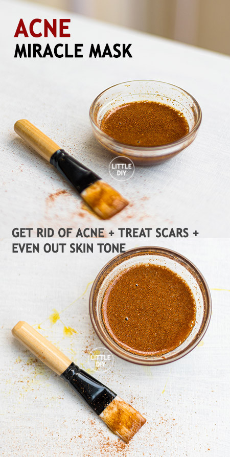Acne DIY Mask
 ACNE MIRACLE MASK LITTLE DIY