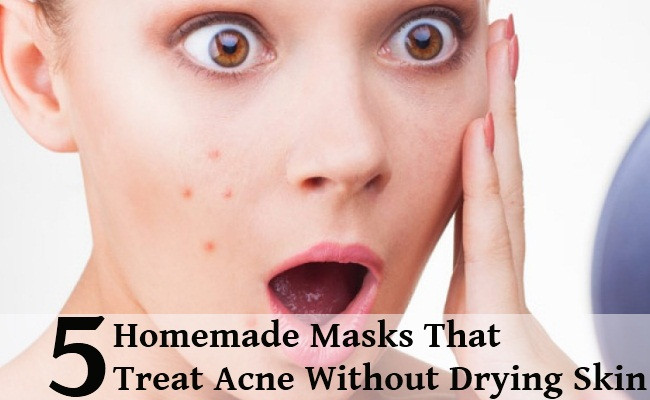 Acne DIY Mask
 DIY 5 Homemade Masks That Treat Acne Without Drying Skin