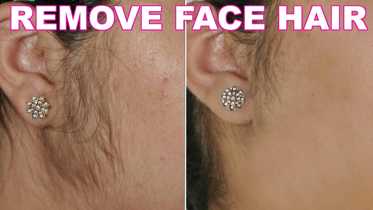 Baby Hair Removal
 How To Remove Facial Hair Naturally