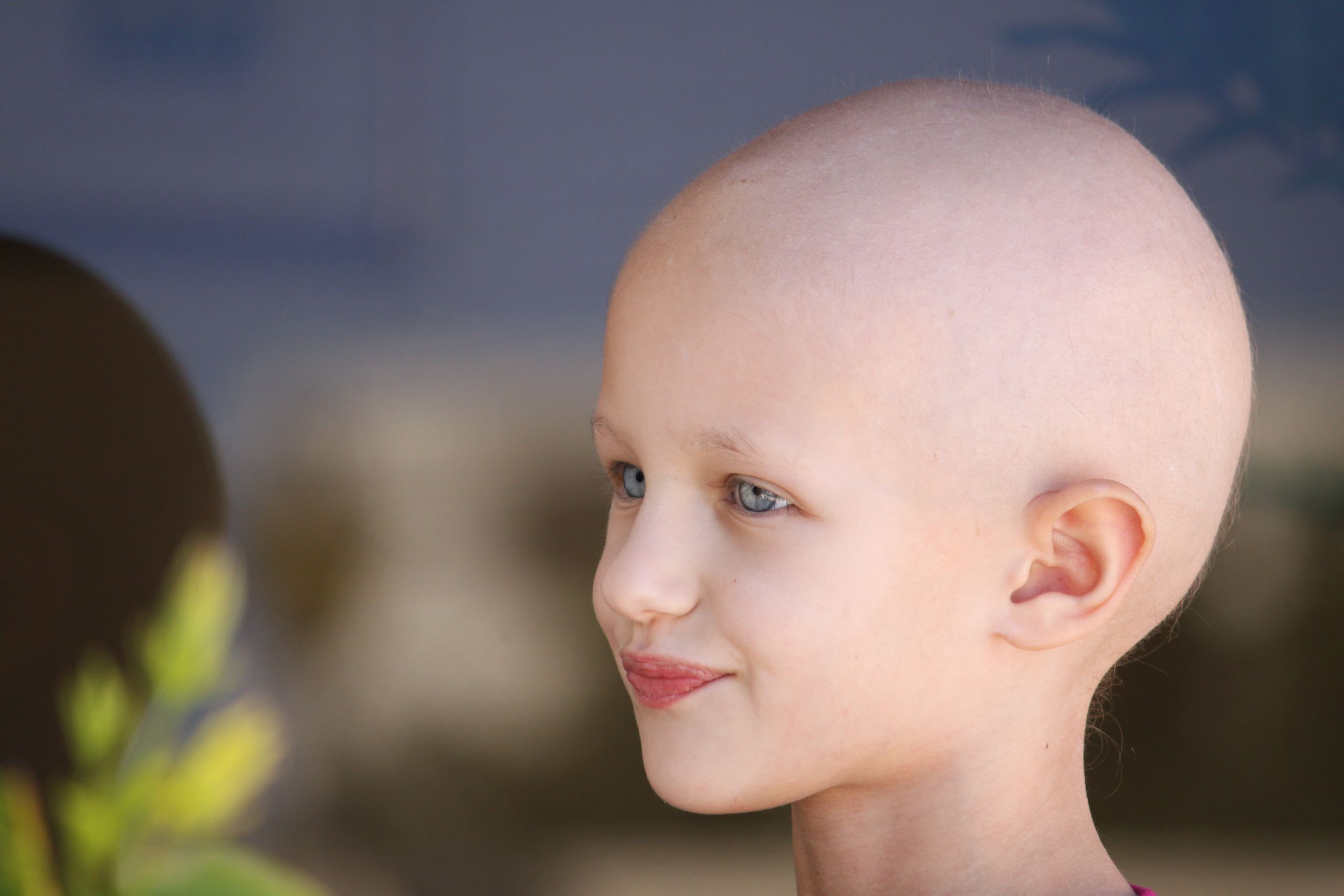 Baby No Hair
 Kids Treated for Cancer at Risk of Pulmonary Fibrosis as