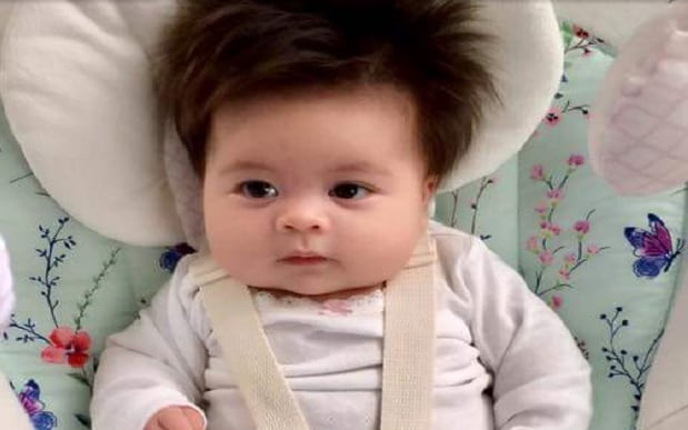 Bald Baby Hair Growth
 Baby with incredible hair wins the internet to make bald