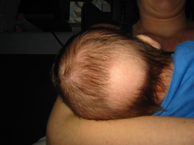 Bald Baby Hair Growth
 4 Mamas What Do Newborns Really Look Like