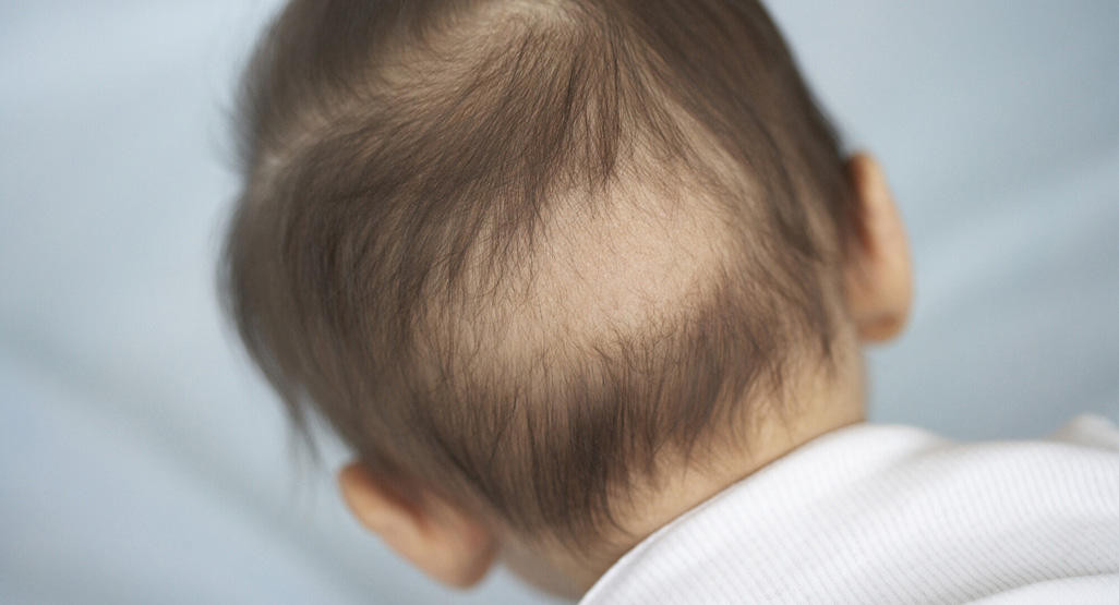 Bald Baby Hair Growth
 Hair loss in babies