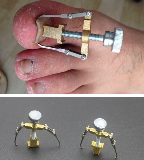 Beautiful Nails Big Bend
 line Buy Wholesale ingrown toenail tool from China