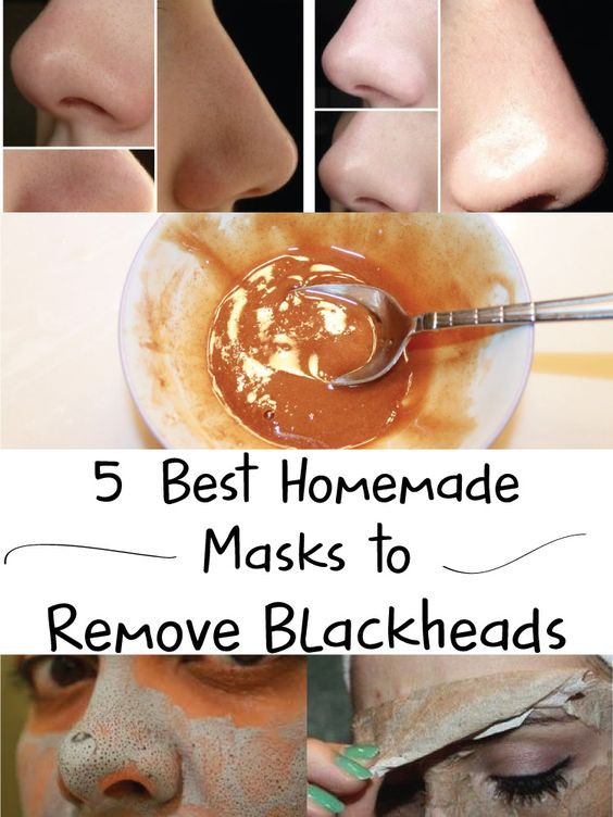Best DIY Blackhead Mask
 Homemade mask Masks and Reme s on Pinterest