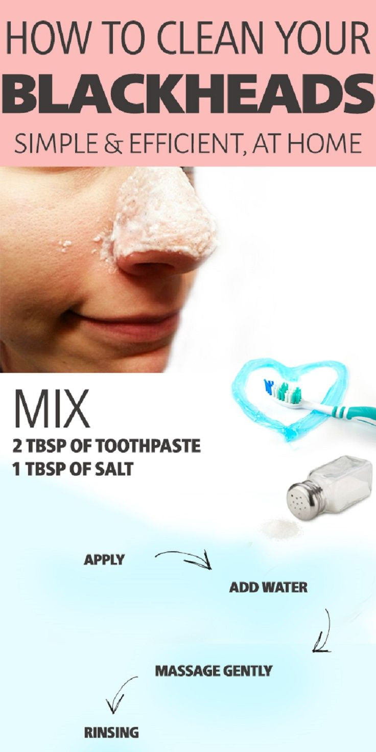 Best Face Mask For Blackhead Removal DIY
 Pin on Love the skin you re in look & feel great in your