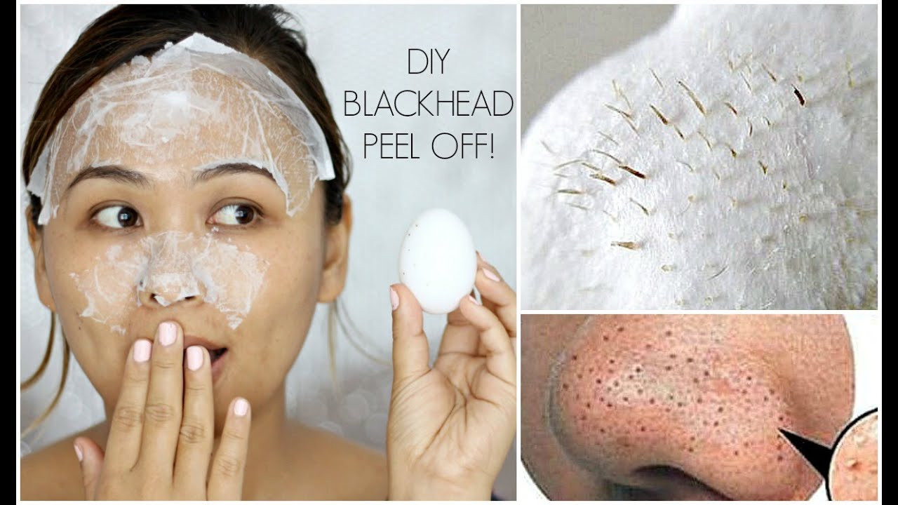 Best Face Mask For Blackhead Removal DIY
 DIY Blackhead Peel f Mask with an Egg