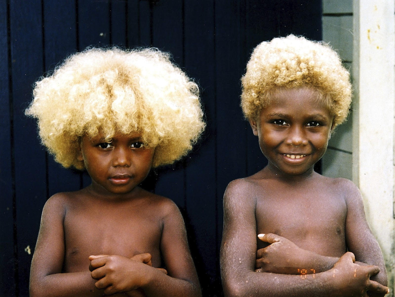 Black Children With Blonde Hair
 Solomon Islands and Papua New Guinea