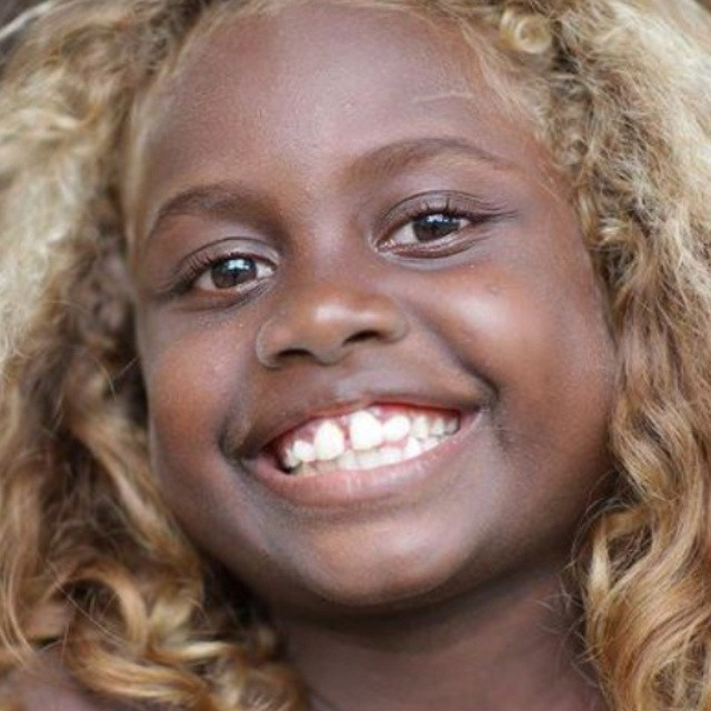 Black Children With Blonde Hair
 Beautiful black child with naturally blonde hair from the