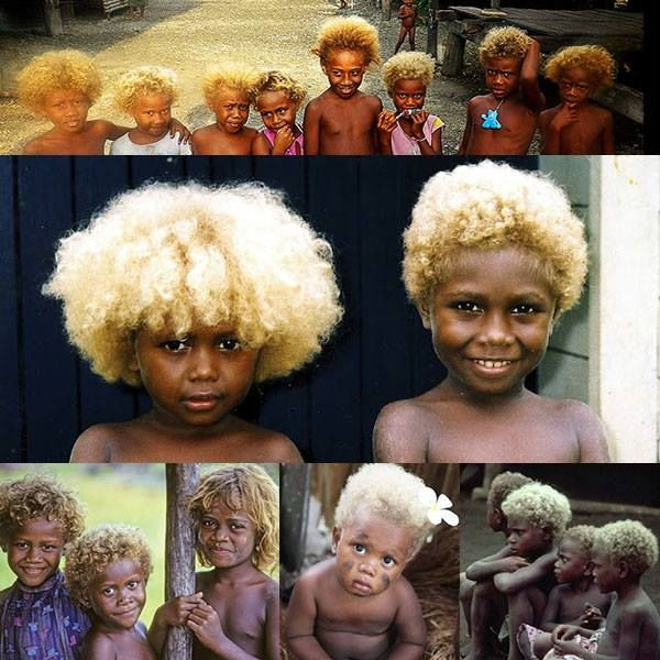 Black Children With Blonde Hair
 Fascinating The Melanesians Have Dark Skin And Naturally