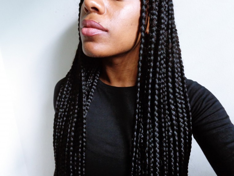 Braids To The Scalp Hairstyles
 5 Ways to Beat Itchy Scalp with Braids