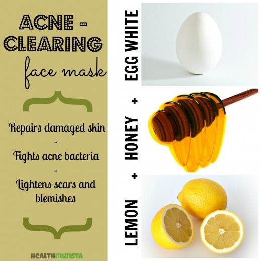 DIY Face Mask For Acne
 11 Easy and Effective DIY Recipes that ll Make Your Acne