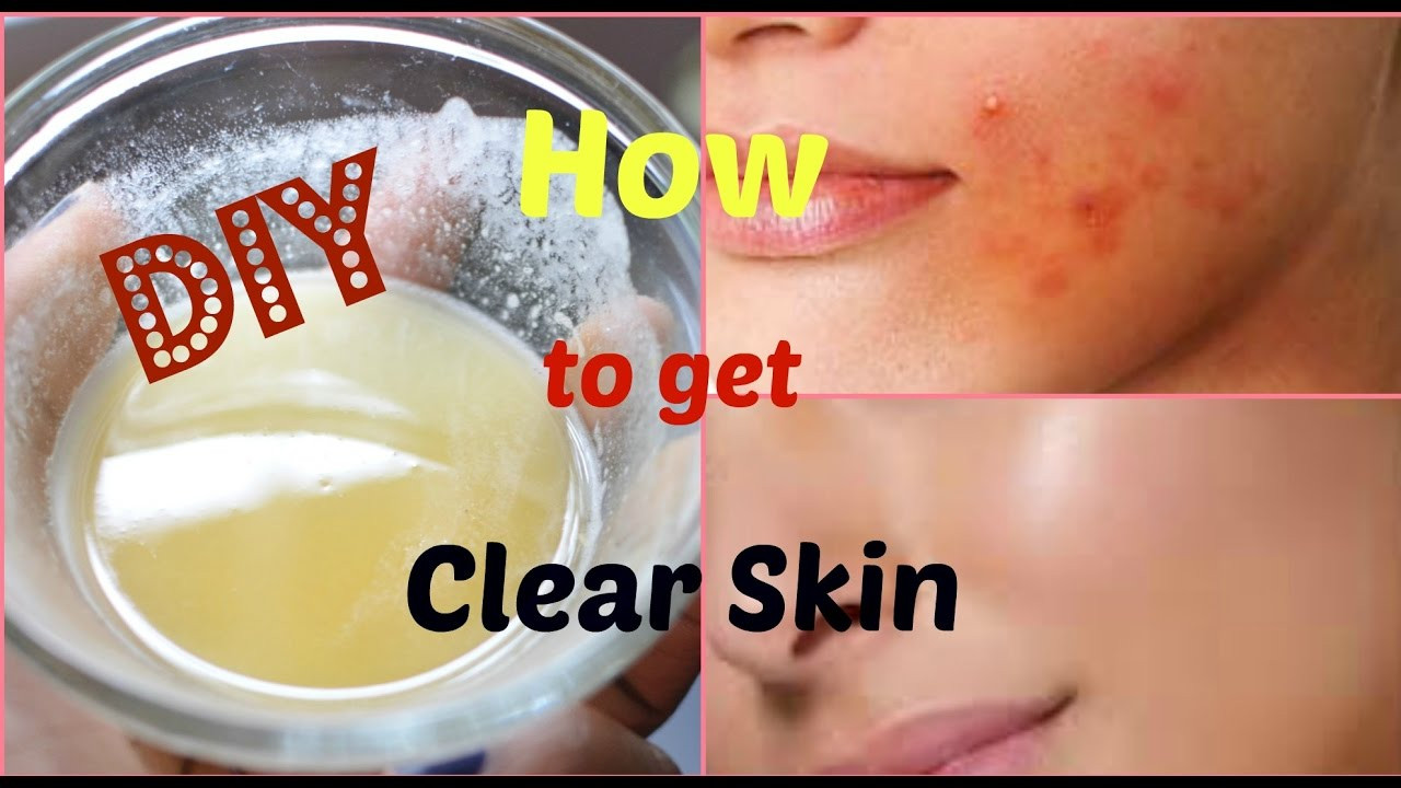 DIY Face Mask For Acne
 DIY Face Mask to Get Rid of Acne & Acne Scars FAST