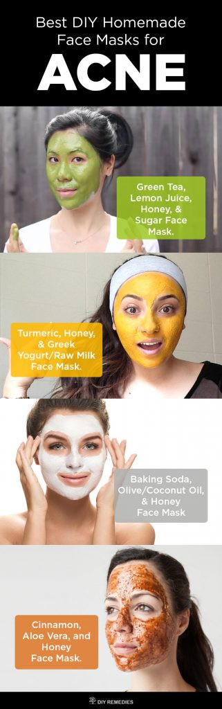 DIY Face Mask For Acne
 6 Best DIY Homemade Face Masks for Acne