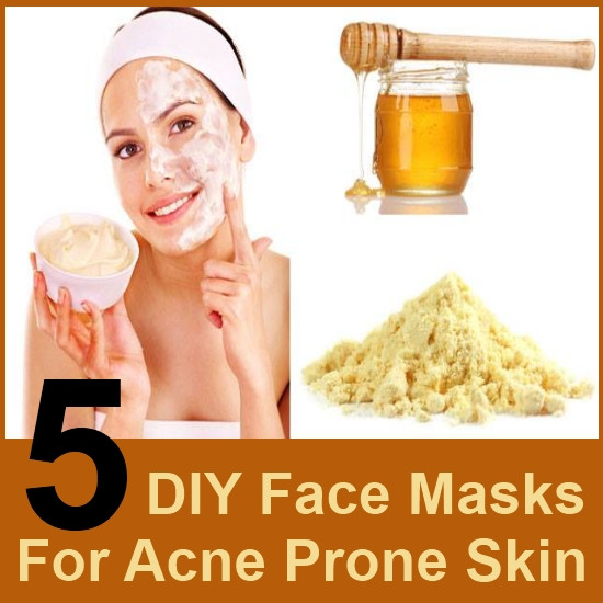 DIY Face Mask For Acne
 5 DIY Face Masks For Acne Prone Skin