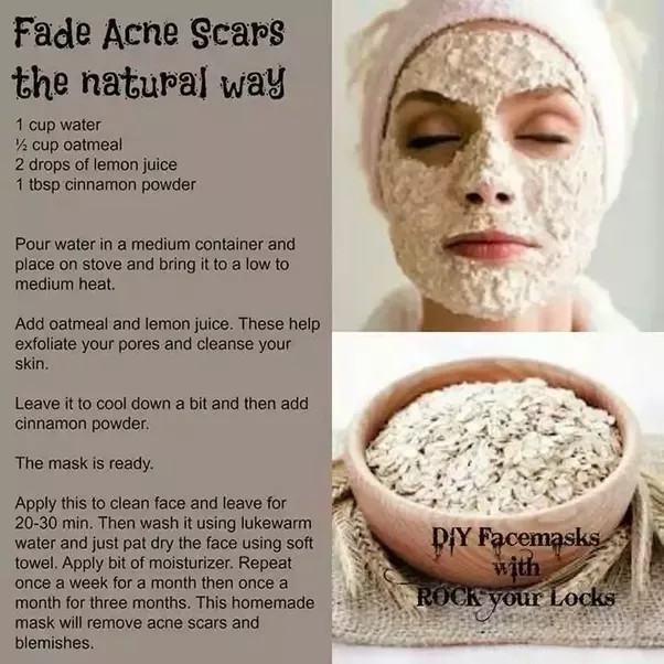 DIY Face Masks For Acne Scars
 What are the best DIY face masks for acne scars Quora