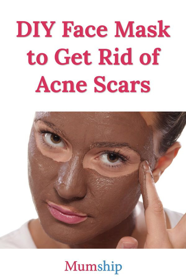 DIY Face Masks For Acne Scars
 Pin on Skin Care Tips