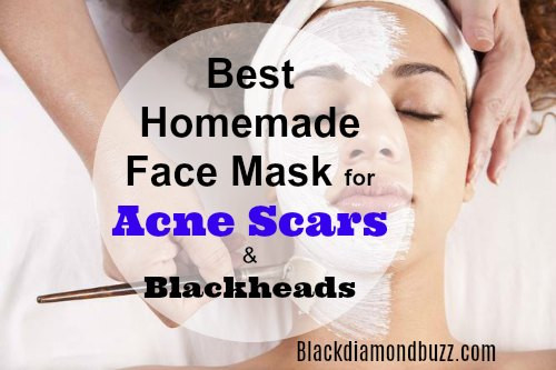 DIY Face Masks For Acne Scars
 DIY Face Mask for Acne 7 Best Homemade Face Masks