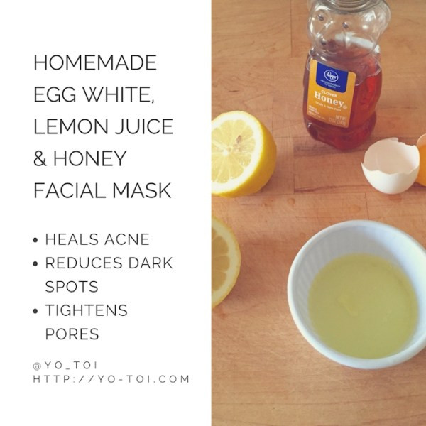 DIY Face Masks For Acne Scars
 Egg White Lemon Juice & Honey Facial Mask for Acne Scars