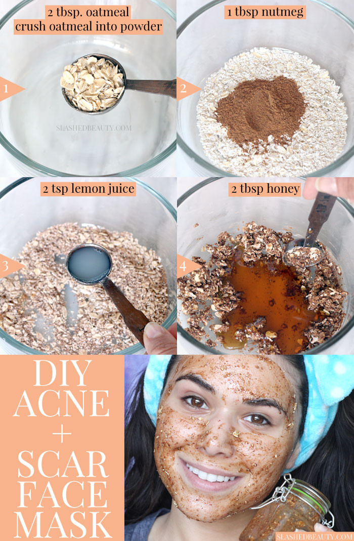 DIY Facial Mask For Acne Scars
 Best DIY Face Mask for Acne & Scars