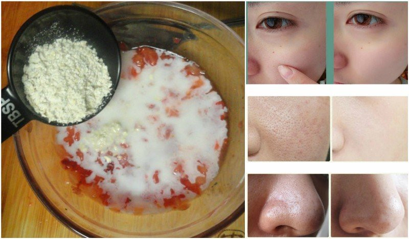 DIY Facial Mask For Pores
 8 Homemade Pore Tightening Face Masks