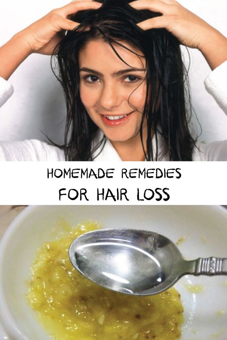 DIY Hair Loss Treatments
 281 best images about hair loss treatments on Pinterest