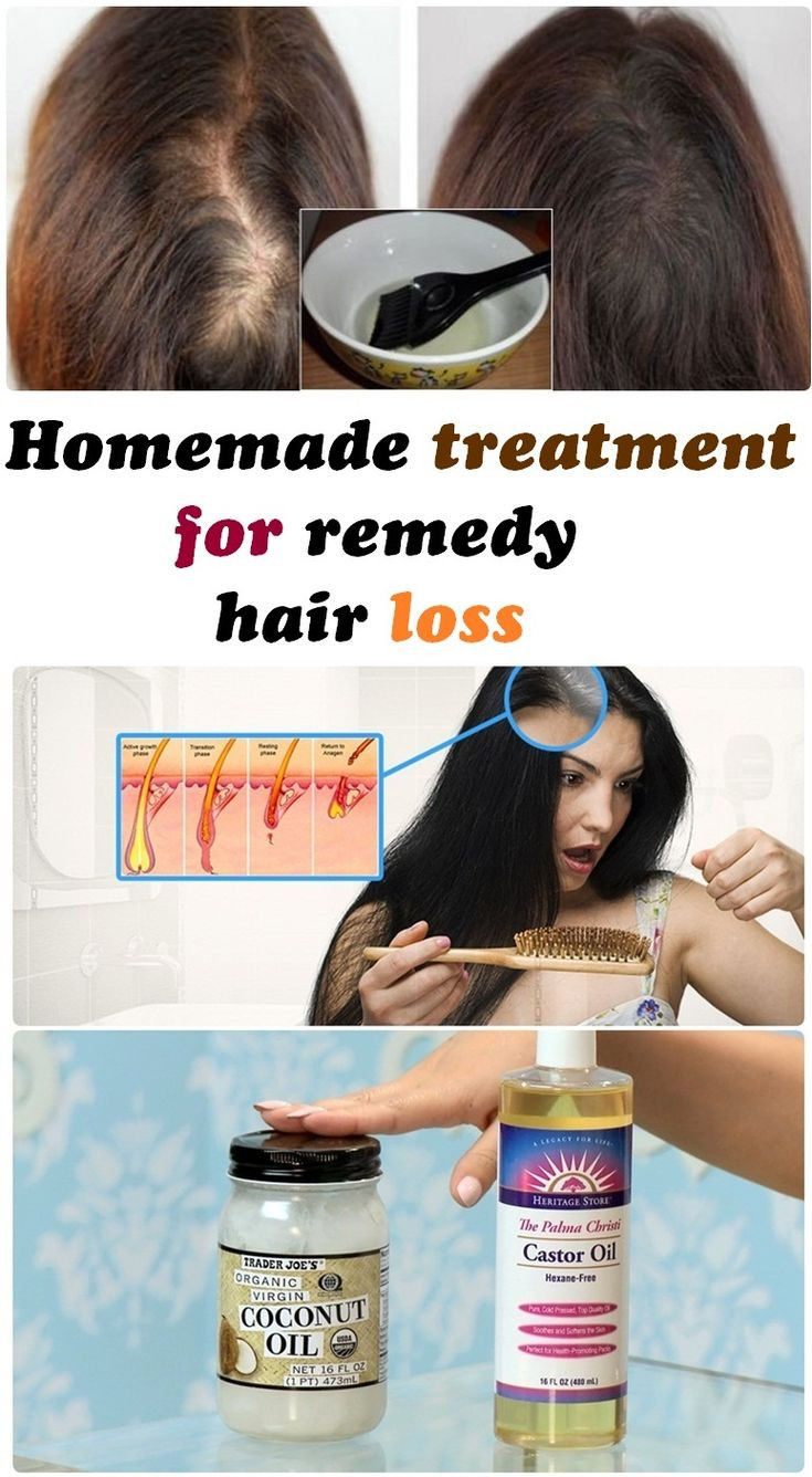 DIY Hair Loss Treatments
 17 Best images about Belleza on Pinterest