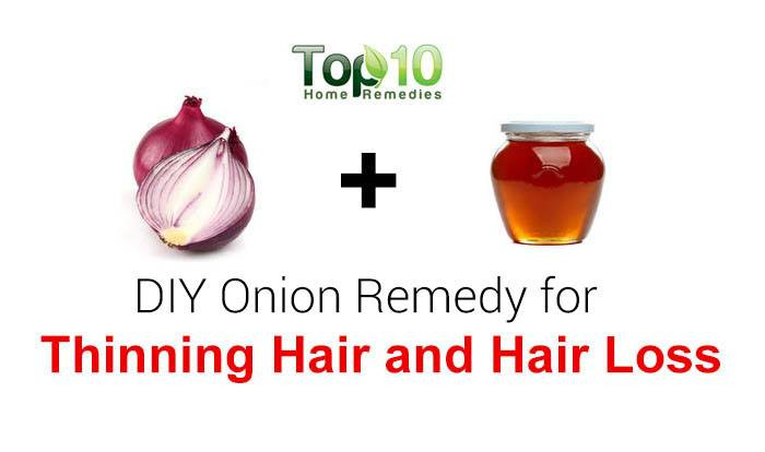 DIY Hair Loss Treatments
 DIY Homemade ion Juice and Honey Hair Loss Treatment