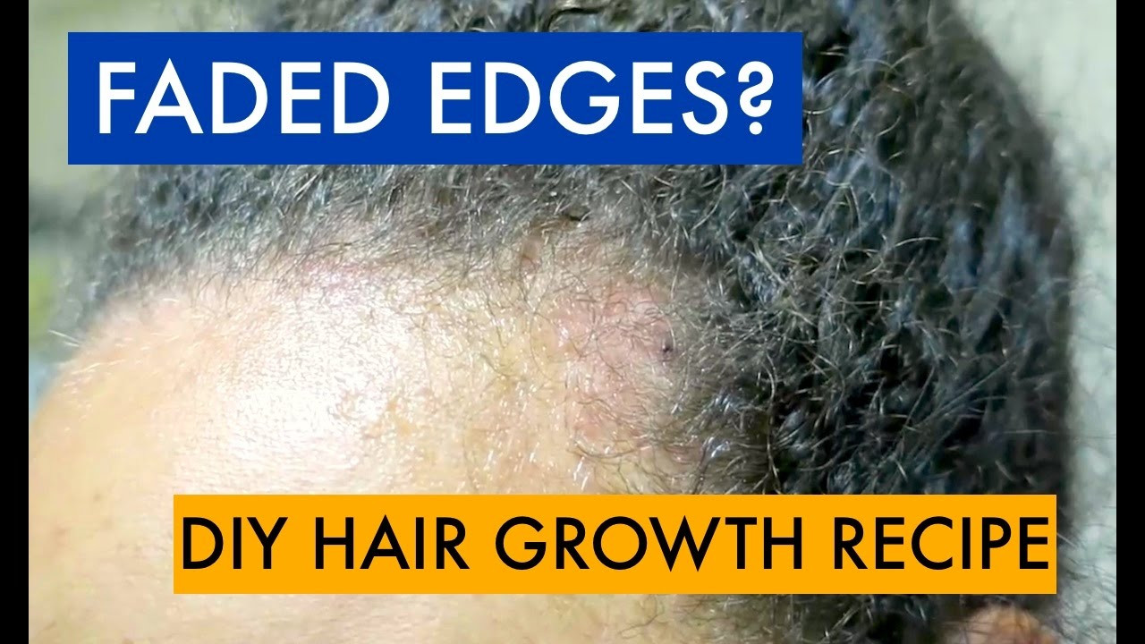DIY Hair Loss Treatments
 HAIR LOSS TREATMENT