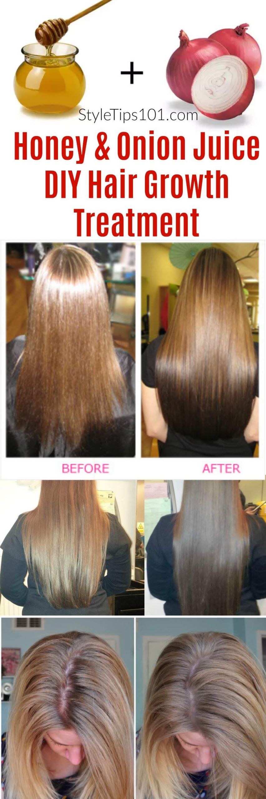 DIY Hair Loss Treatments
 ion Juice & Honey DIY Hair Growth Treatment