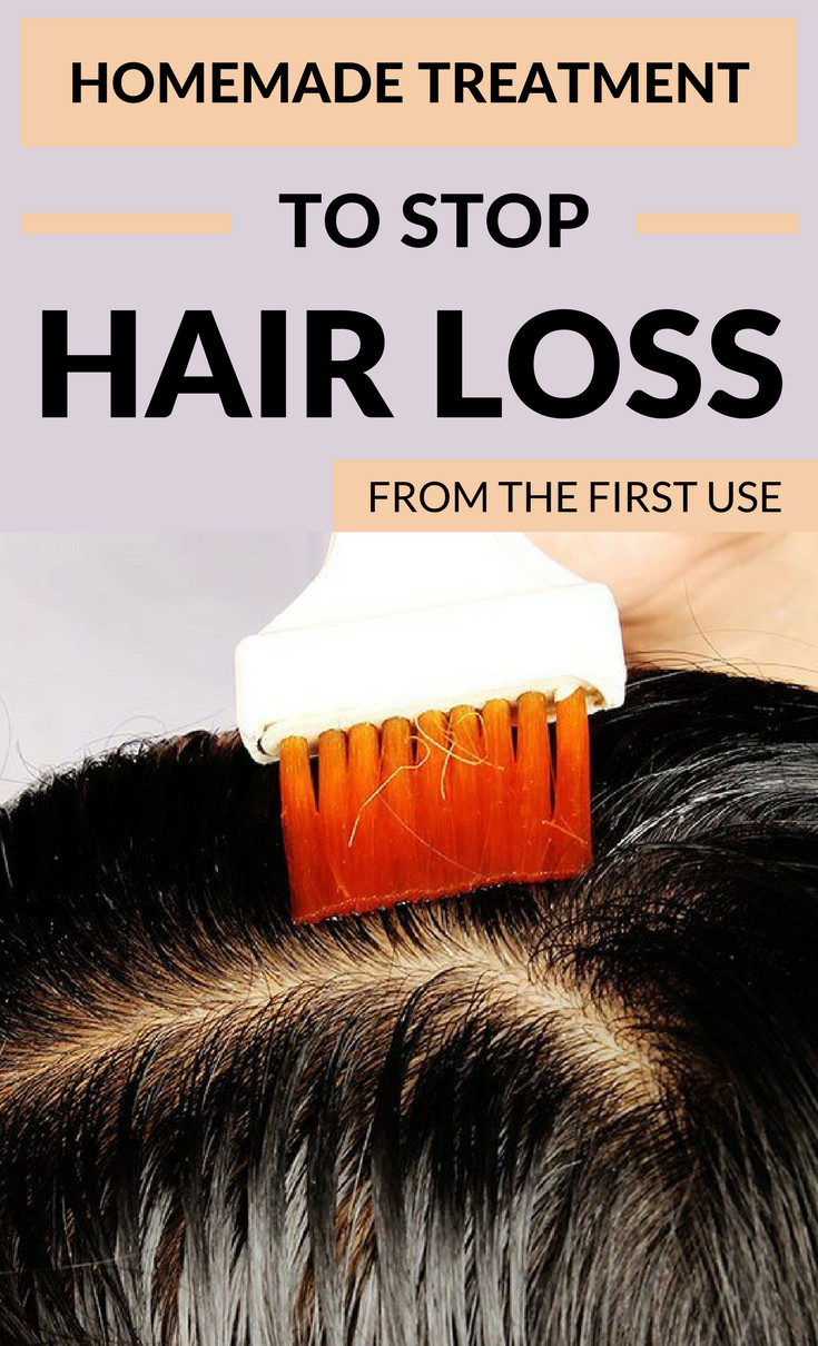 DIY Hair Loss Treatments
 Homemade Treatment To Stop Hair Loss From The First Use