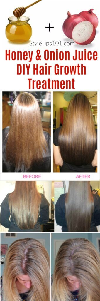 DIY Hair Treatment
 ion Juice & Honey DIY Hair Growth Treatment