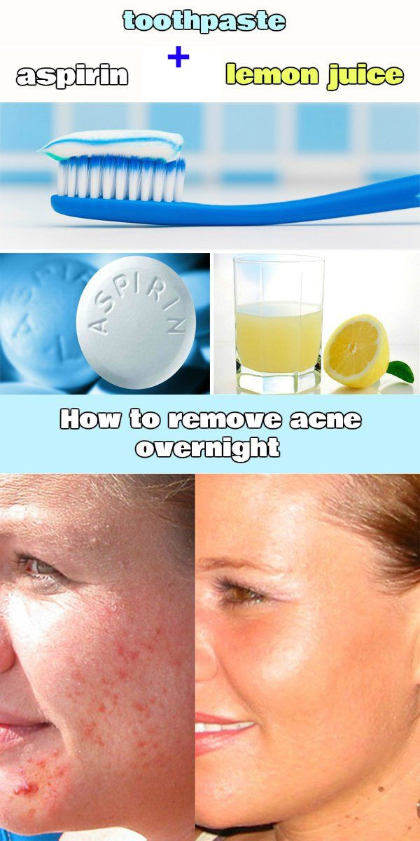 DIY Overnight Face Mask For Acne
 How To Get Rid Acne Fast Diy