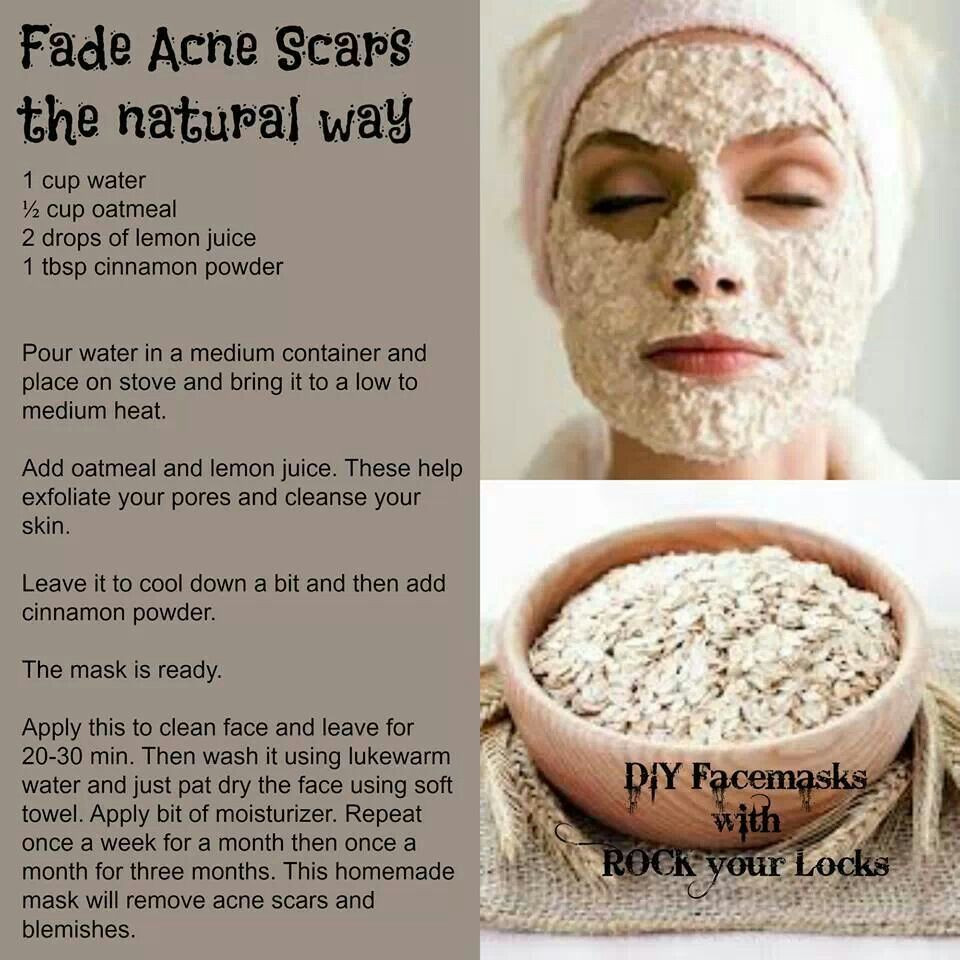 DIY Overnight Face Mask For Acne
 Fade Acne scars the natural way