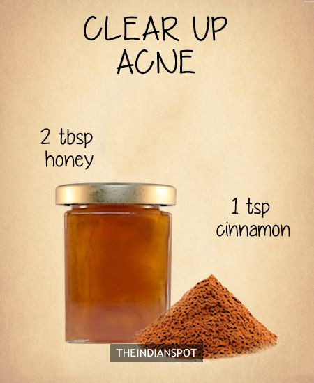 DIY Overnight Face Mask For Acne
 10 Amazing 2 ingre nts all natural homemade face masks