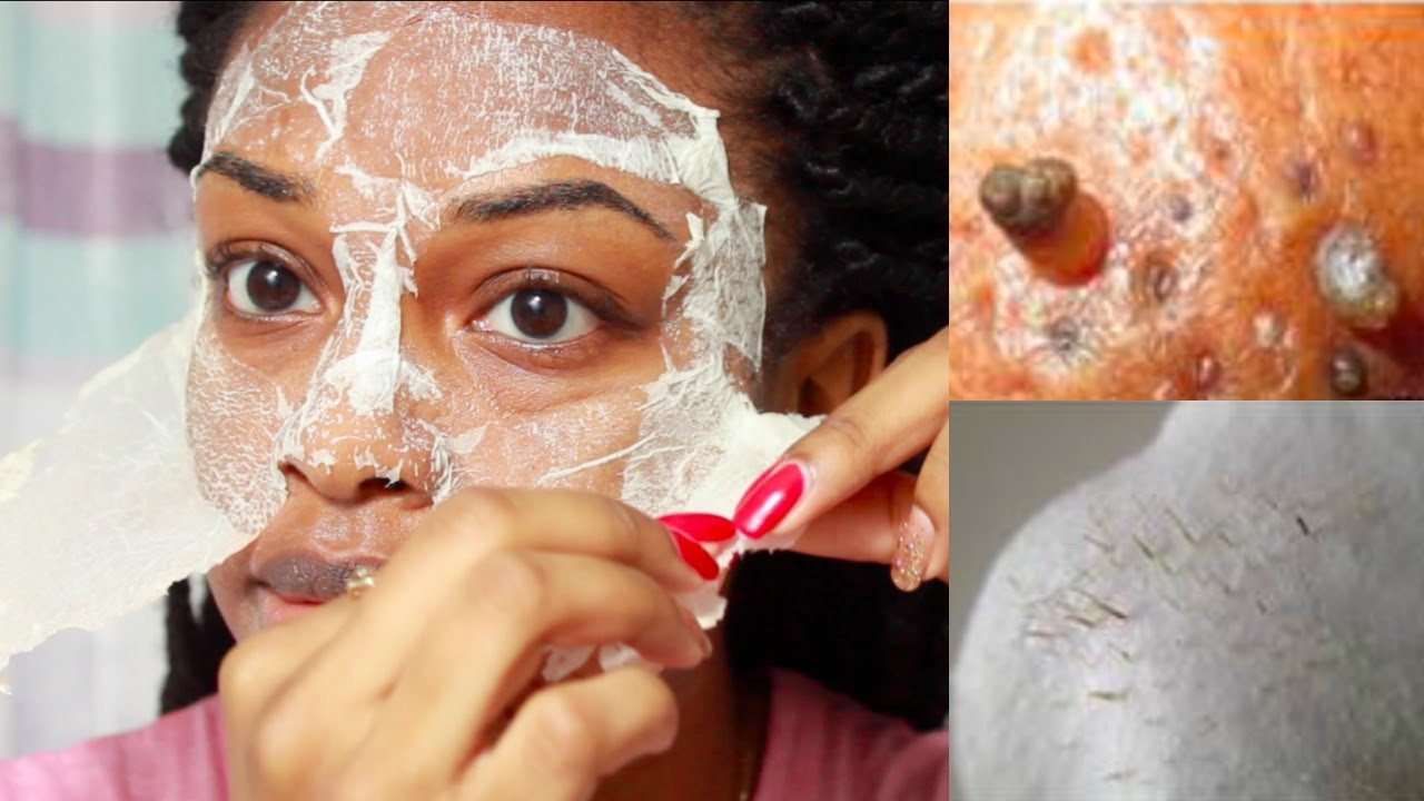 DIY Peeling Face Mask
 EASY DIY Egg Blackhead Remover Peel f Mask