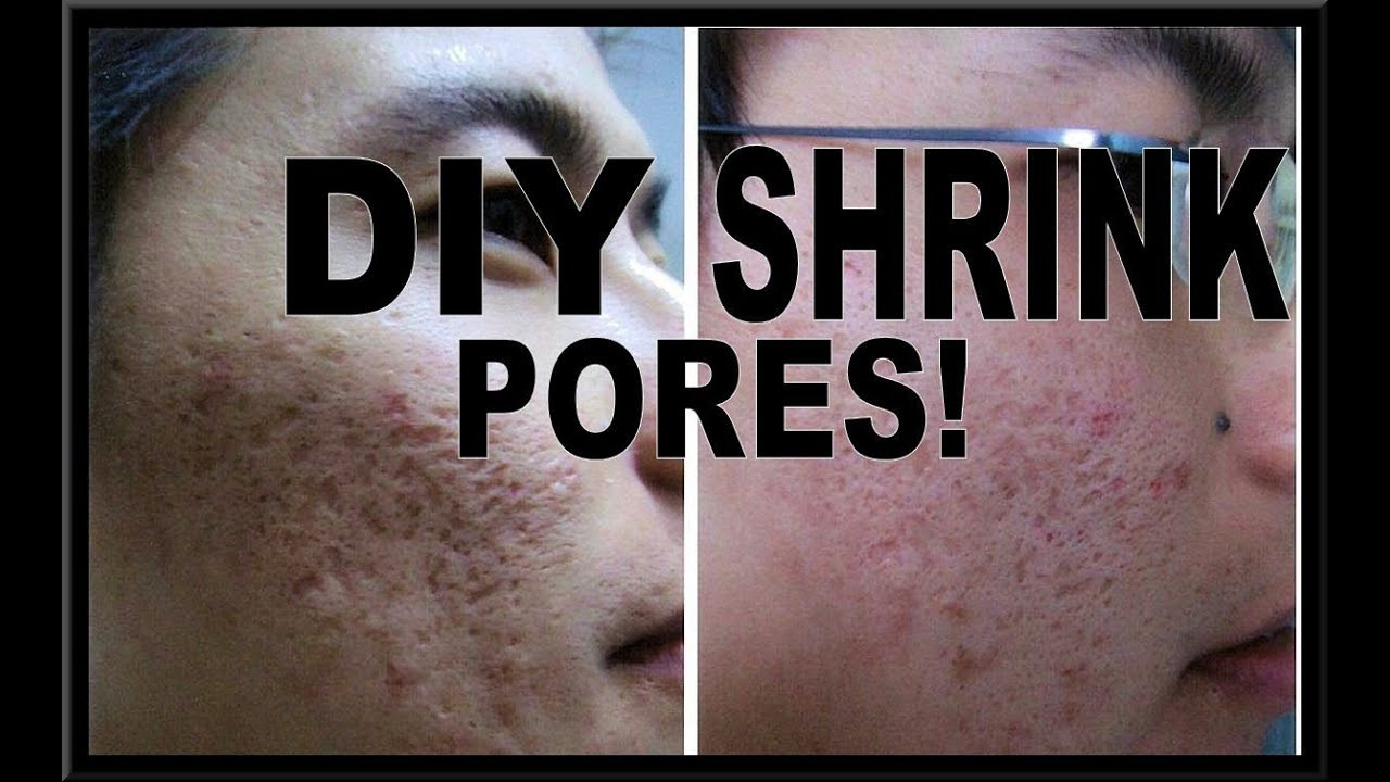 DIY Pore Mask
 HOW TO SHRINK PORES DIY PORE MINIMIZING MASK