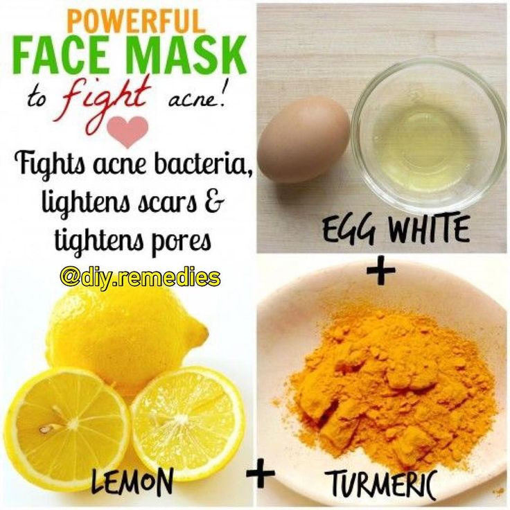 DIY Pore Minimizing Mask
 powerful face mask which fight bacteria and minimize pores