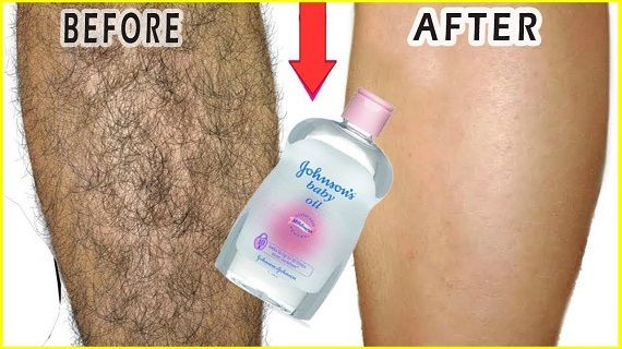 DIY Pubic Hair Removal
 In 3 Days Remove Unwanted Hair Permanently No shave No