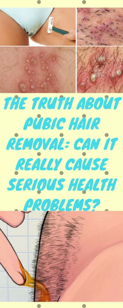 DIY Pubic Hair Removal
 THE TRUTH ABOUT PUBIC HAIR REMOVAL CAN IT REALLY CAUSE