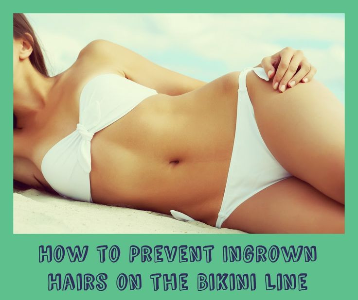 DIY Pubic Hair Removal
 74 best Ingrown Hair Solutions images on Pinterest