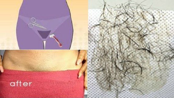 DIY Pubic Hair Removal
 Remove Pubic Hair at Home Naturally & Permanently