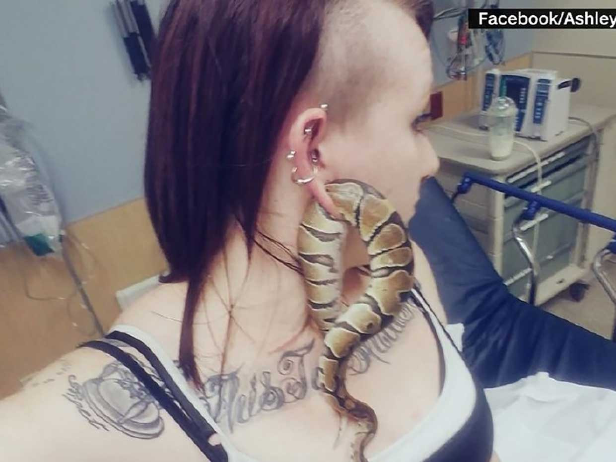 Earring Back Stuck In Earlobe
 Woman s snake stuck in ear piercing