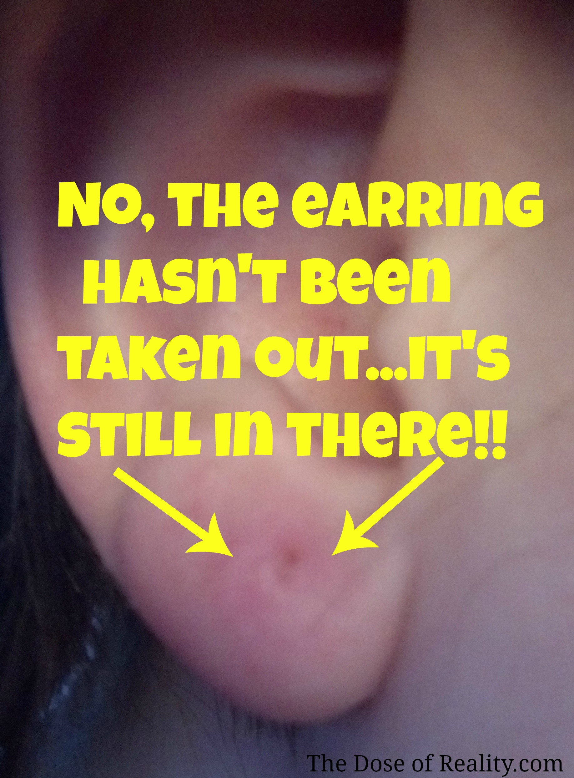 Earring Back Stuck In Earlobe
 Get Laughed Out The Emergency Room