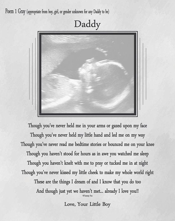 Father'S Day Gift Ideas For Soon To Be Dads
 Father s Day Gift for Expecting Dad From Unborn Baby